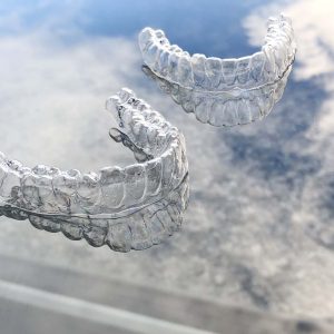 Invisalign Bremen – unsichtbare Zahnspange